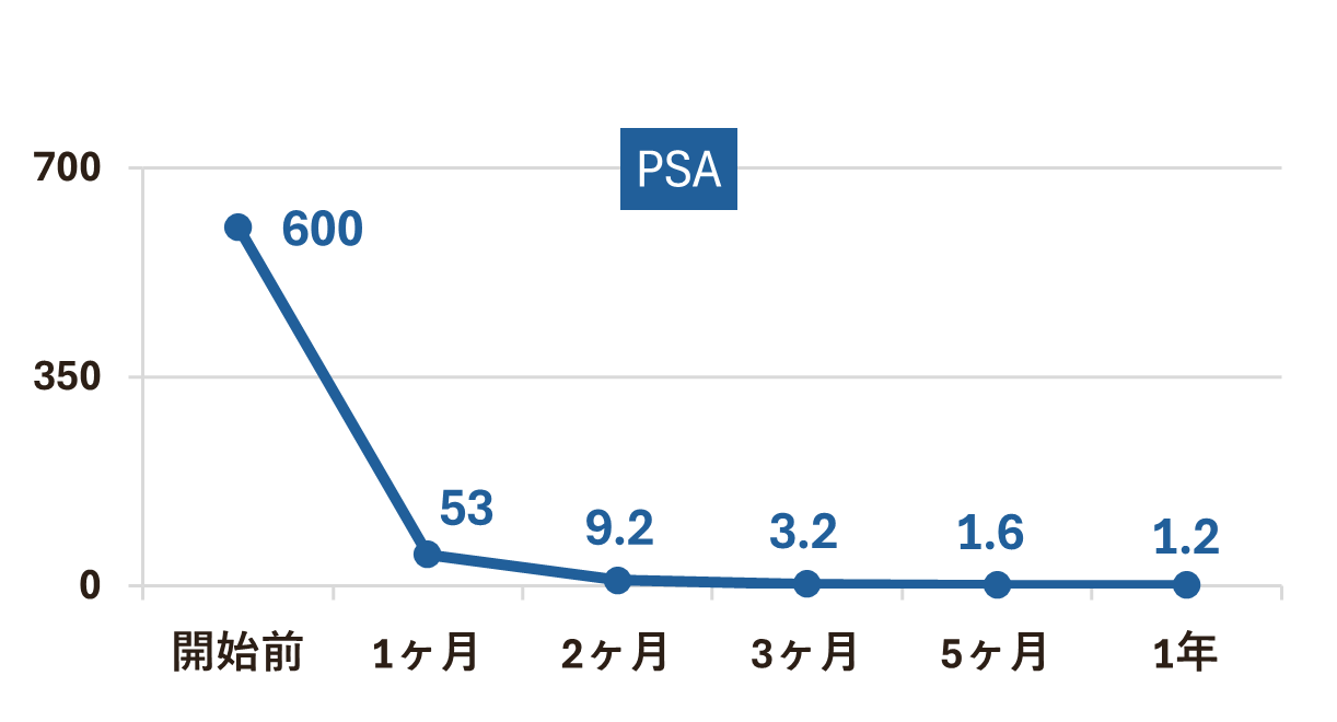 悪性度の高い前立腺がん、たったの5ヶ月でPSA600→1.6へ。 ｜ 症例紹介