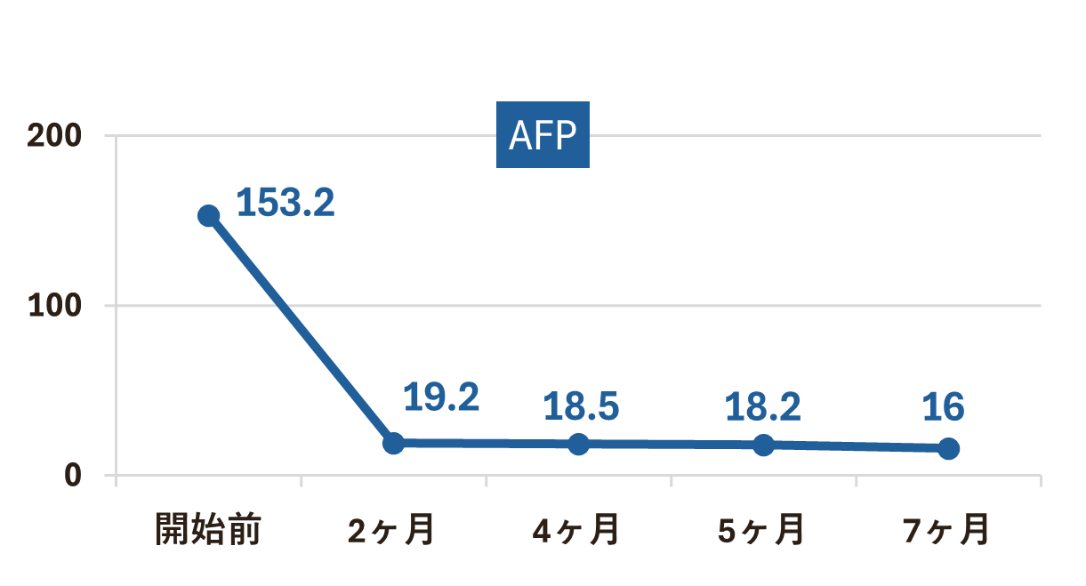 末期の肝臓癌、肝臓は完全消失、肺転移も大幅縮小。 ｜ 症例紹介