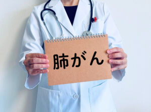 肺がんと書いた紙を持った医師